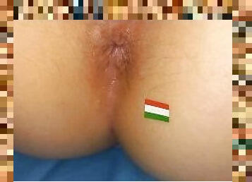 Hungary anus