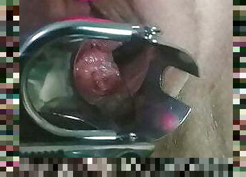 Massive squirt on the camera lens after speculum and double penetration