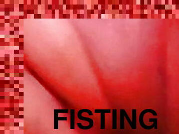 fistingas