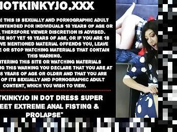 Hotkinkyjo in dot dress super sweet extreme anal fisting & prolapse