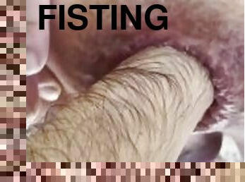 extrem, fisting, anal, hardcore, gay, kuk